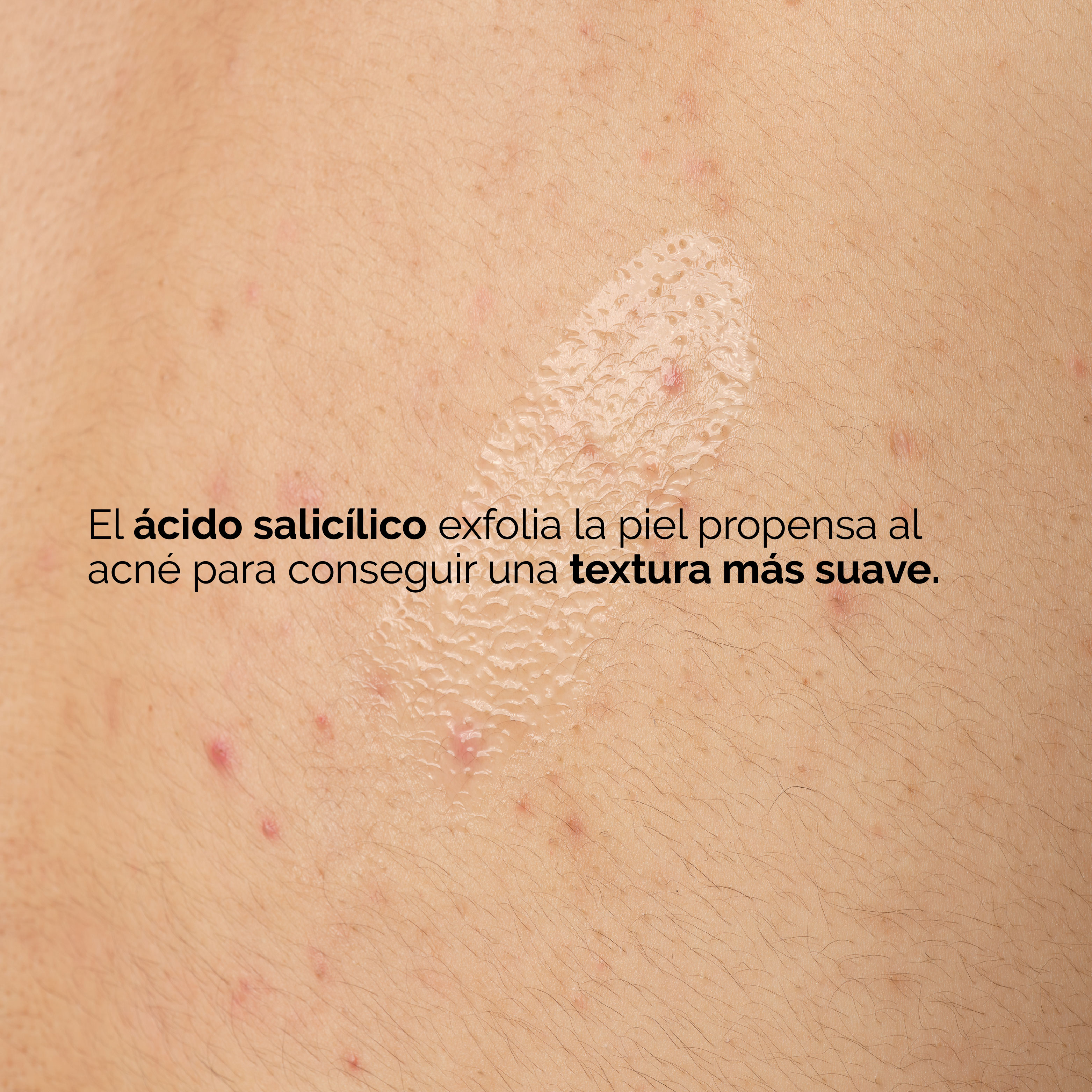 SALICYLIC ACID 0.5% BODY SERUM (SUERO CORPORAL EXFOLIANTE CON ÁCIDO SALICÍLICO)